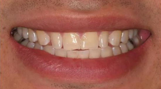 Before image