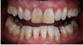 Before image