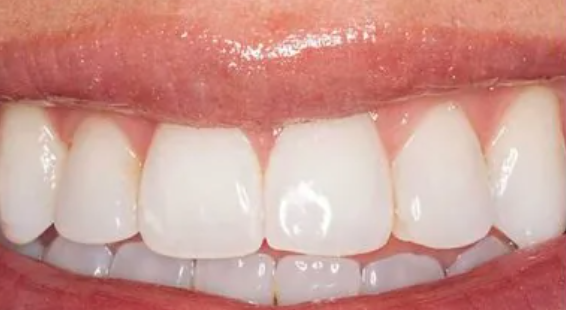 Before image