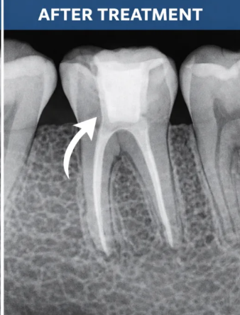 Before image